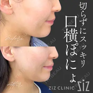 症例
