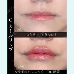 ルラ美容クリニック 札幌大通り院 能登 貴弘医師の症例