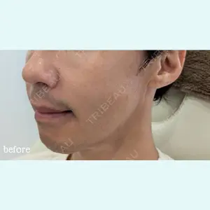 神戸スイミー皮膚科美容外科の症例