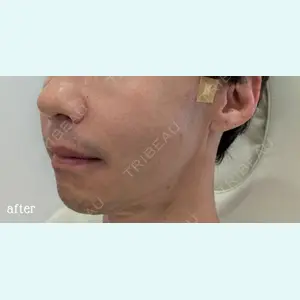 神戸スイミー皮膚科美容外科の症例