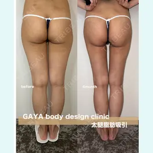 GAYA body design clinicの症例