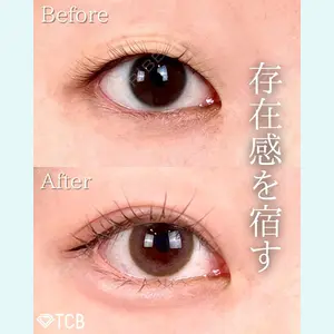 TCB東京中央美容外科 新宿三丁目院 篠永 宏行医師の症例