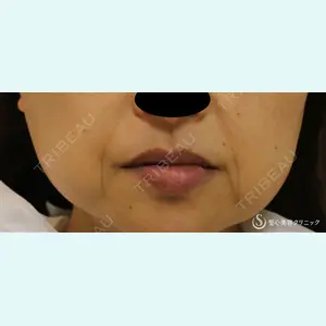 聖心美容クリニック 熱海院 小林 美幸（皮膚科）医師の症例
