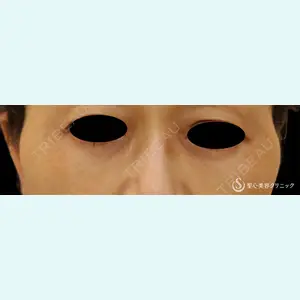 聖心美容クリニック 熱海院 小林 美幸（皮膚科）医師の症例