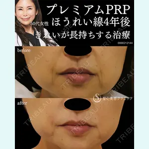 聖心美容クリニック 熱海院 小林 美幸（皮膚科）医師の症例