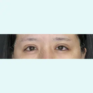 共立美容外科 立川院 濱田　えりか医師の症例