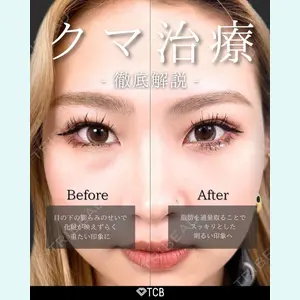 TCB東京中央美容外科 新宿三丁目院 篠永 宏行医師の症例