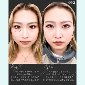 TCB東京中央美容外科 新宿三丁目院 篠永 宏行医師の症例