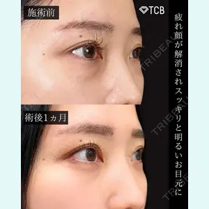 TCB東京中央美容外科 新宿三丁目院 篠永 宏行医師の症例