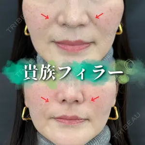 症例