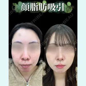 症例
