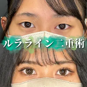 症例