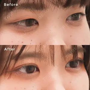 症例
