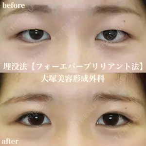 大塚美容形成外科 札幌院の症例