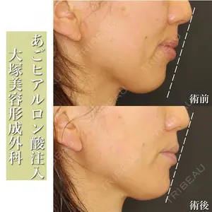 大塚美容形成外科 京都院の症例