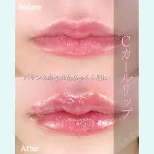症例
