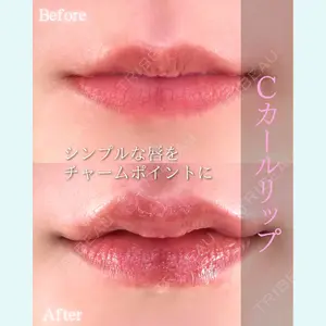 症例