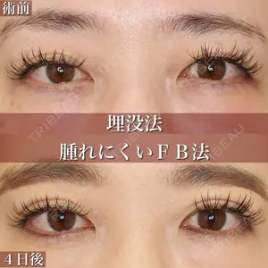 大塚美容形成外科 銀座本院 石井秀典医師の症例