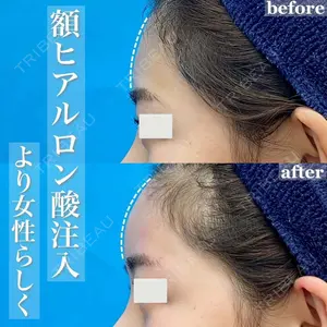 大塚美容形成外科 札幌院の症例
