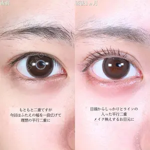 アリエル美容クリニック 大宮院 鈴木　桂介医師の症例