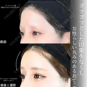 アリエル美容クリニック 大宮院 鈴木　桂介医師の症例