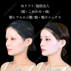 アリエル美容クリニック 大宮院 鈴木　桂介医師の症例