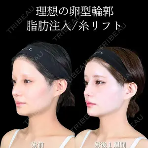 アリエル美容クリニック 大宮院 鈴木　桂介医師の症例