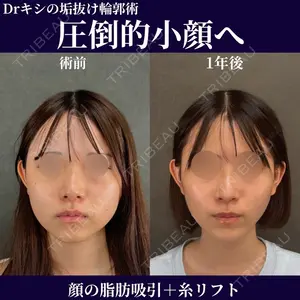 ネビュラクリニック 京都院 岸 大輔医師の症例