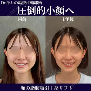 ネビュラクリニック 京都院 岸 大輔医師の症例