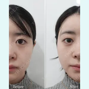 L‘amour clinic Tokyo【ラムールクリニック東京】の症例