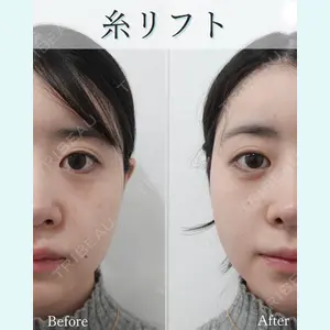 L‘amour clinic Tokyo【ラムールクリニック東京】の症例