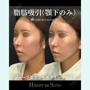 シンデレラ＆ダヴィンチクリニック 佐藤 博文医師の症例