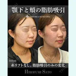 シンデレラ＆ダヴィンチクリニック 佐藤 博文医師の症例