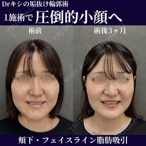 ネビュラクリニック 京都院 岸 大輔医師の症例