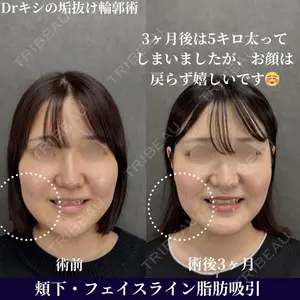 ネビュラクリニック 京都院 岸 大輔医師の症例