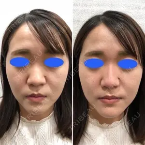 しのぶ皮膚科 蘇原しのぶ医師の症例