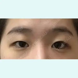 症例