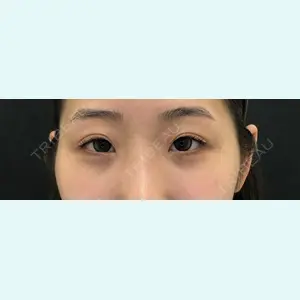 共立美容外科 大阪本院 木檜　周医師の症例
