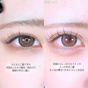 アリエル美容クリニック 大宮院 鈴木　桂介医師の症例