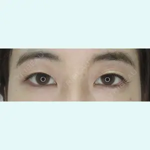 症例