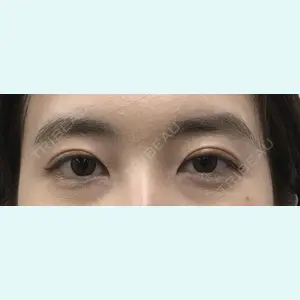 症例