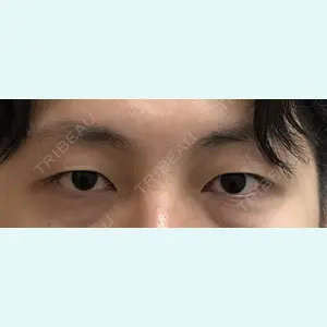 症例