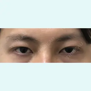 症例