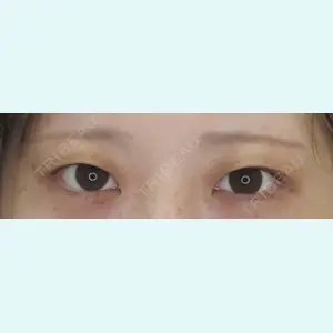 症例