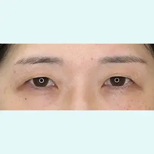 症例