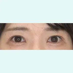 症例