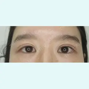 症例