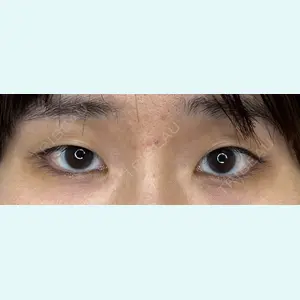 症例