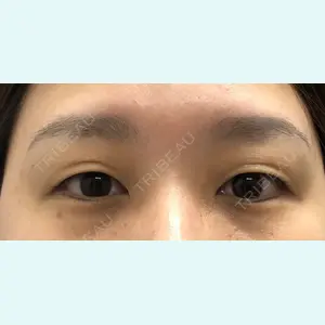 症例