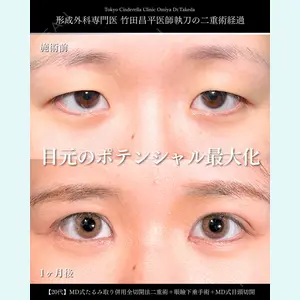症例